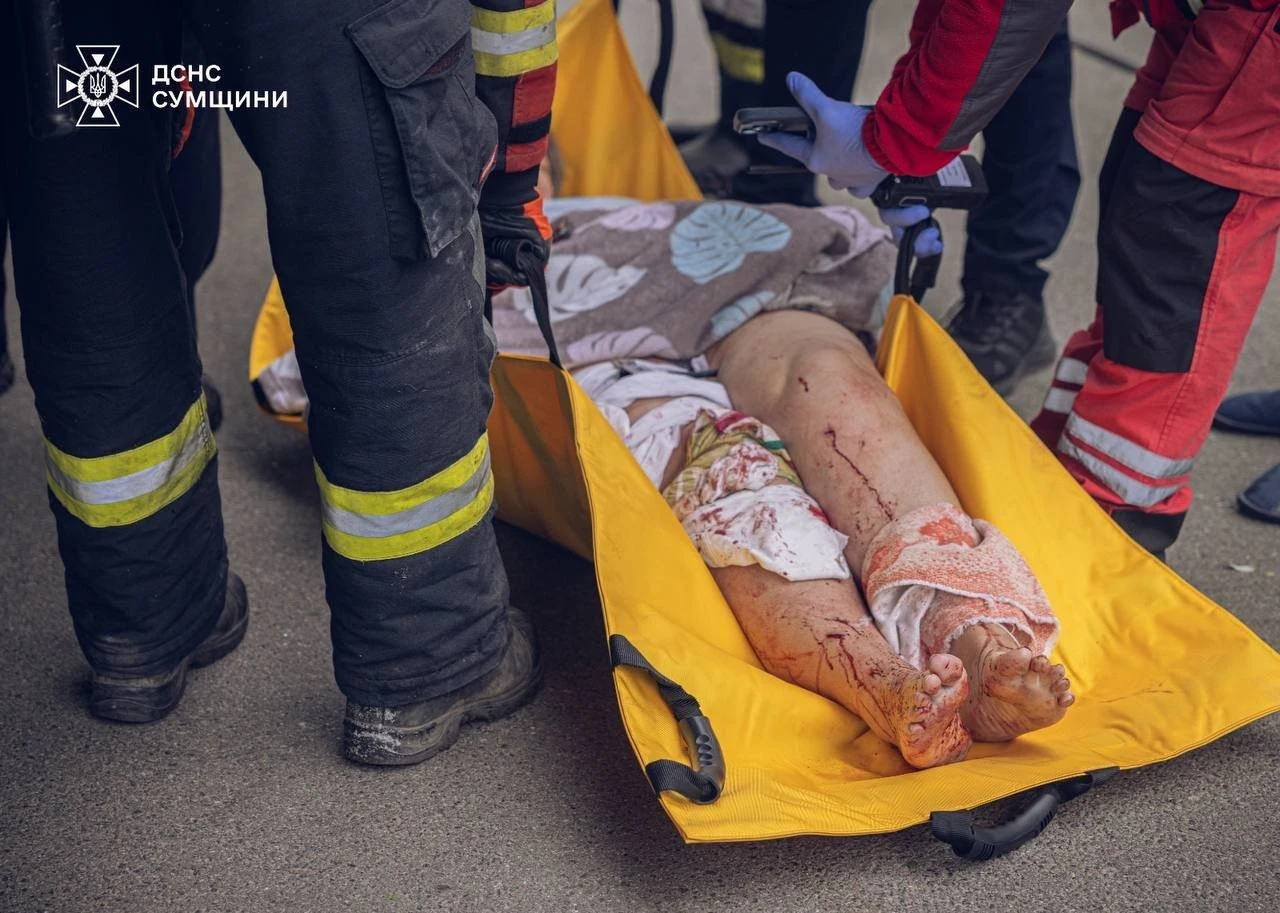 Російські удари по Сумах: кількість постраждалих цивільних продовжує зростати